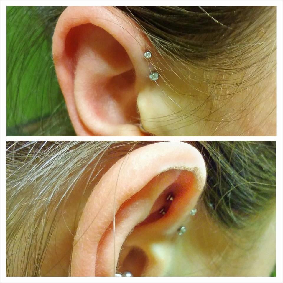 Forward Helix